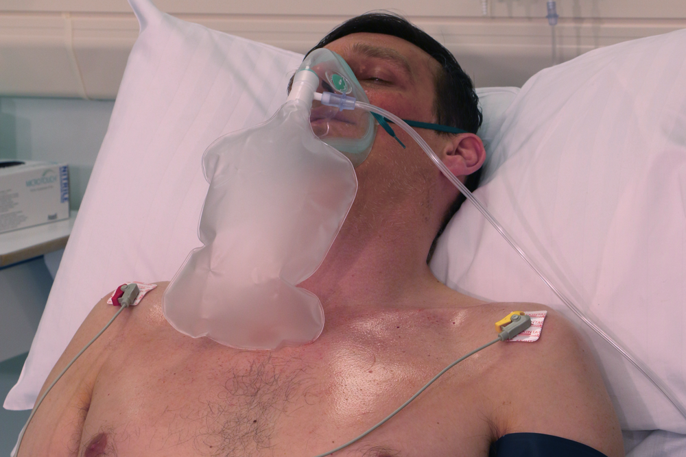 Man with anaphylaxis in hospital bed.