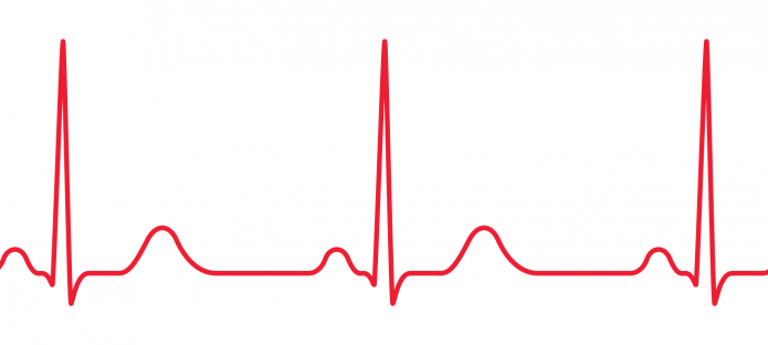 A red ECG on a white background