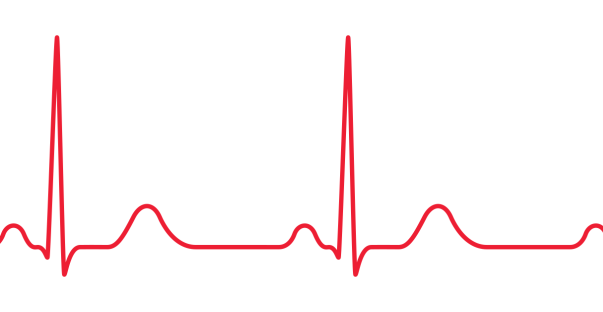 An ECG line in red