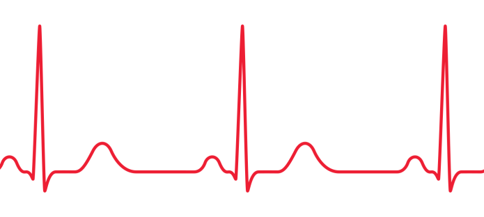 An ECG line in red