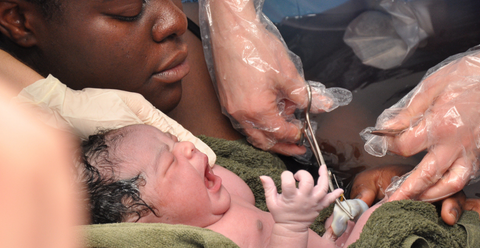 newborn baby with umbilical cord being cut