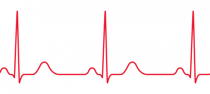 ECG line